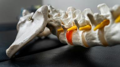 Lumbar Disc Surgery