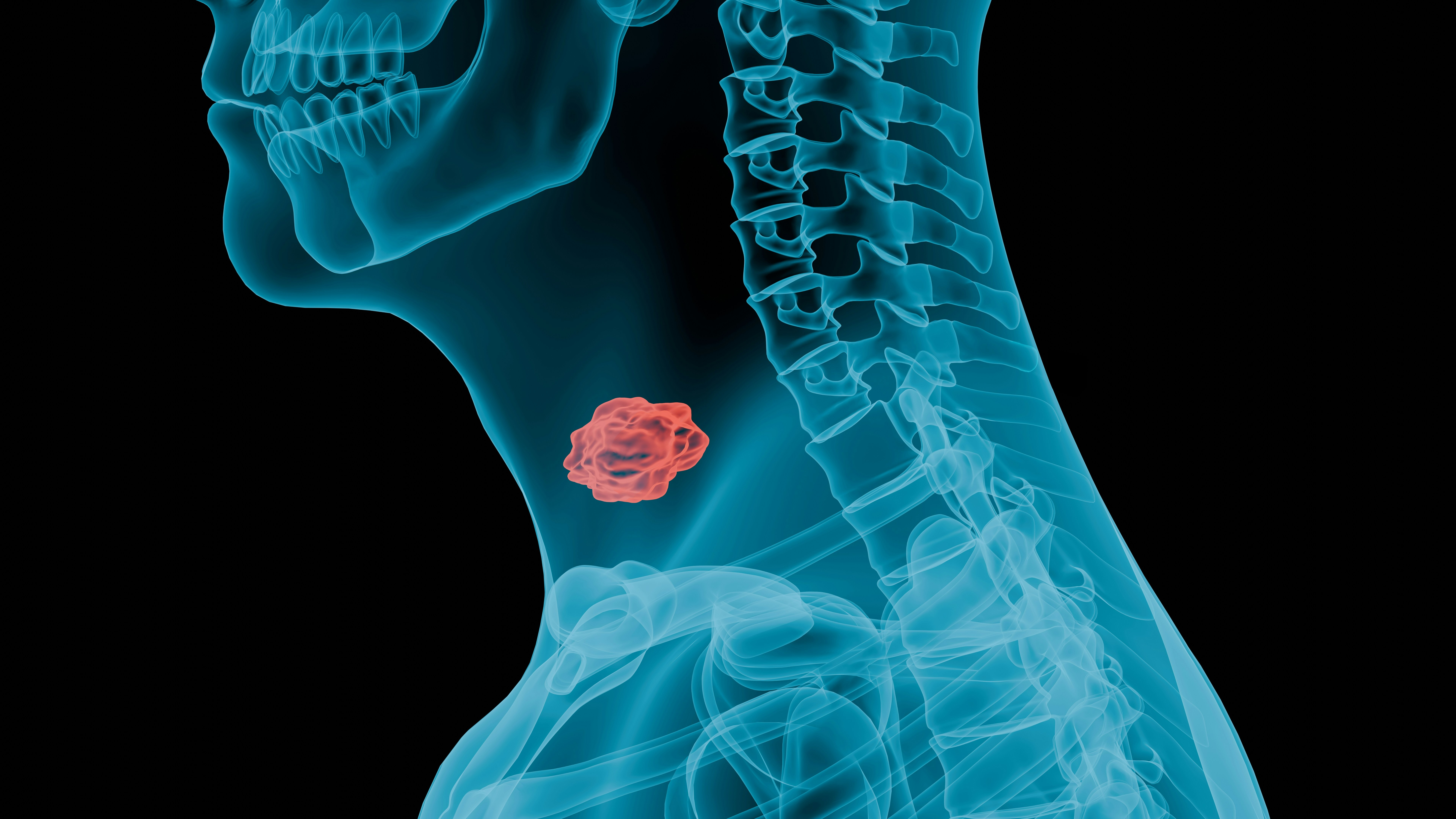 Head And Neck Cancer Surgery