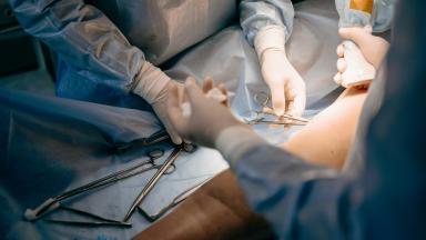 Free Flap Reconstruction