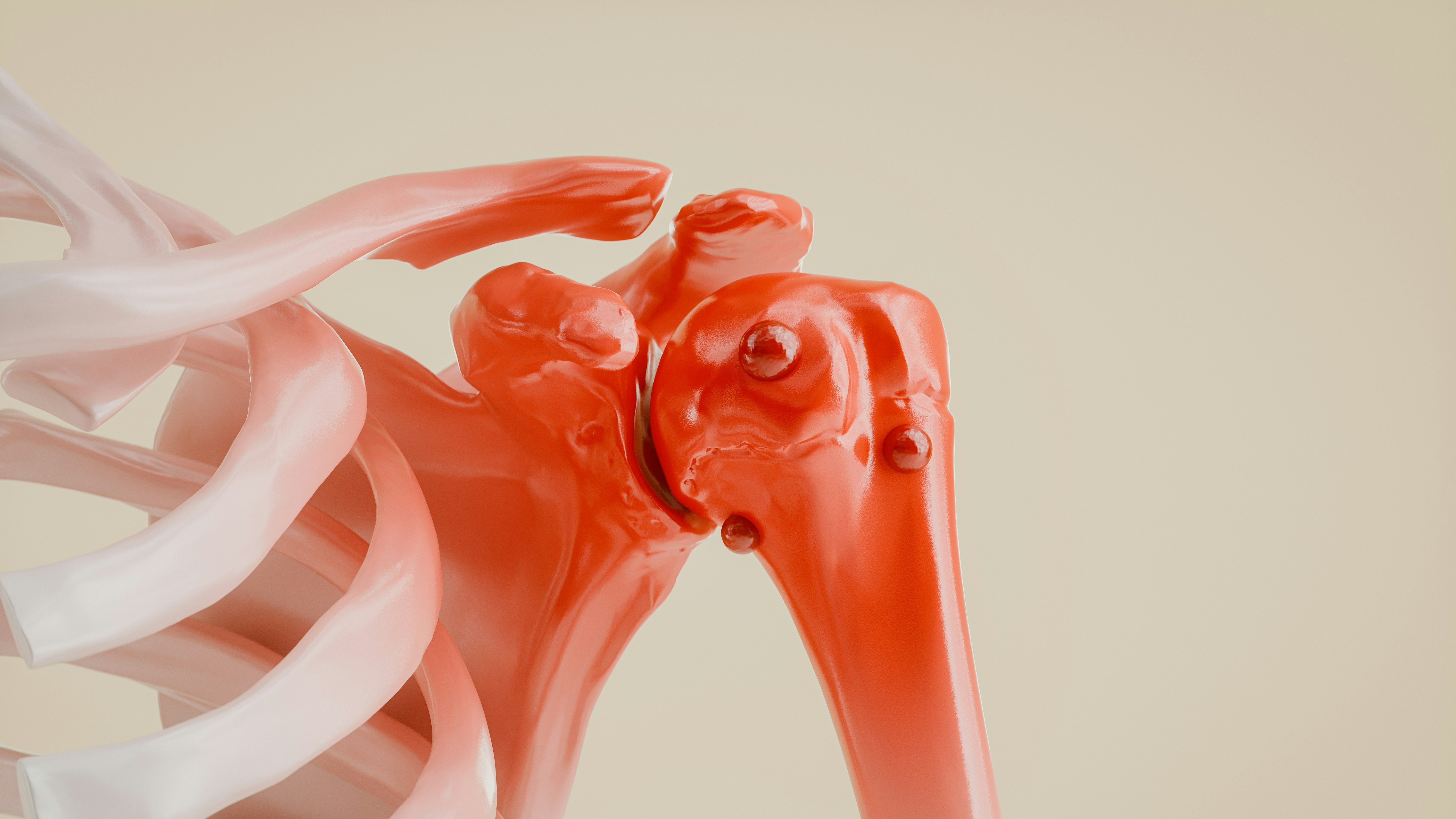 Chondrosarcoma Surgery and Bone Tumor Resection