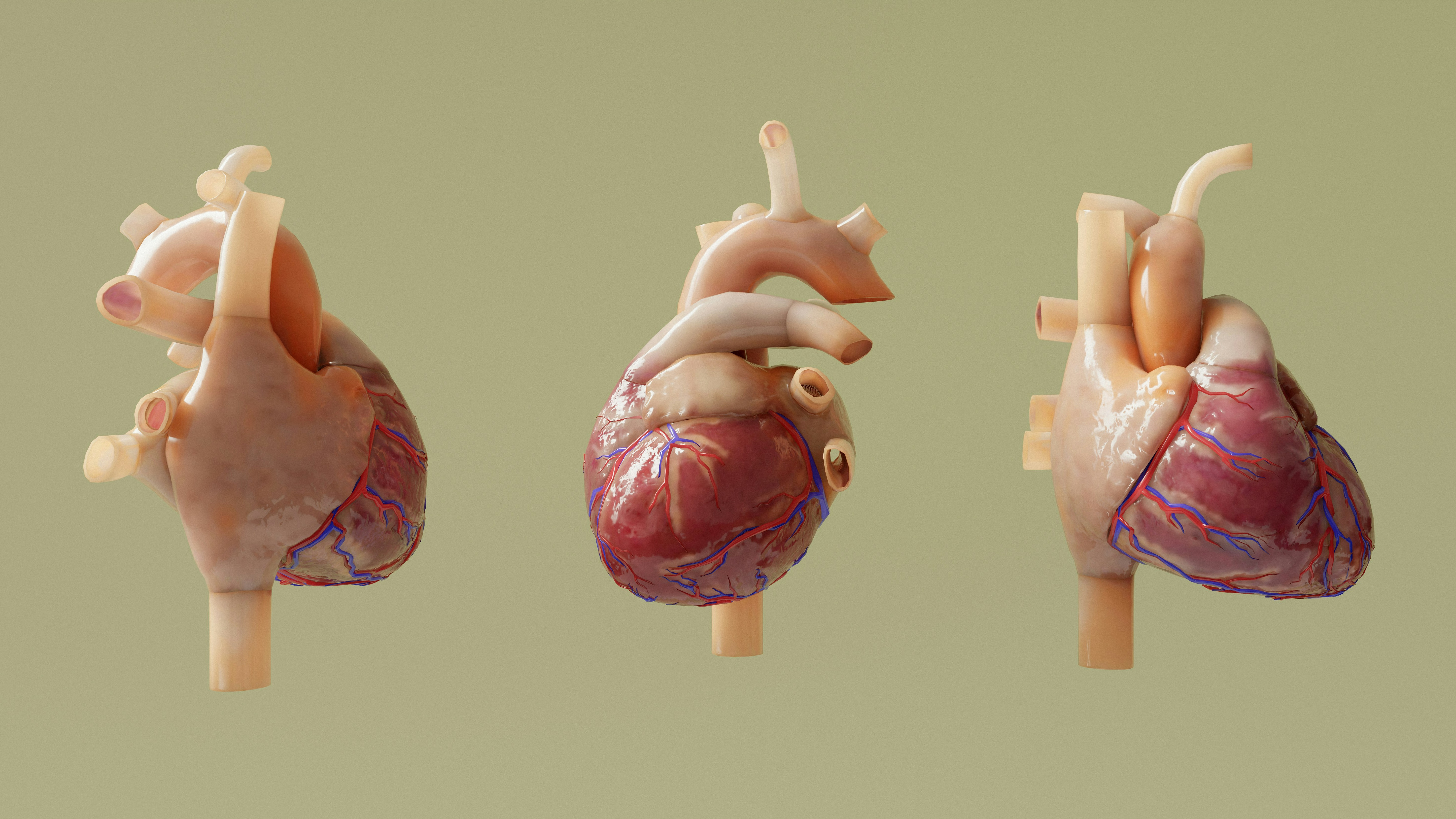 Mitral Valve Repair