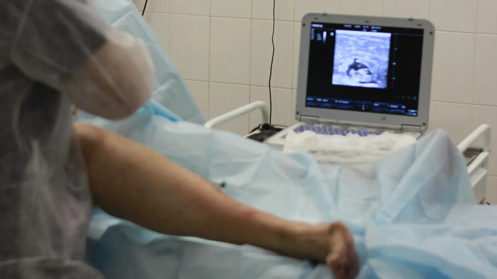 Robotic Knee Prosthesis Surgery