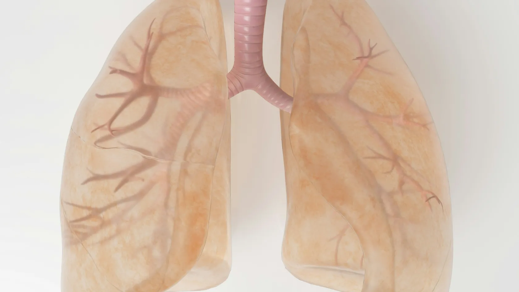 Lobectomy - Lung Lobe Removal Surgery