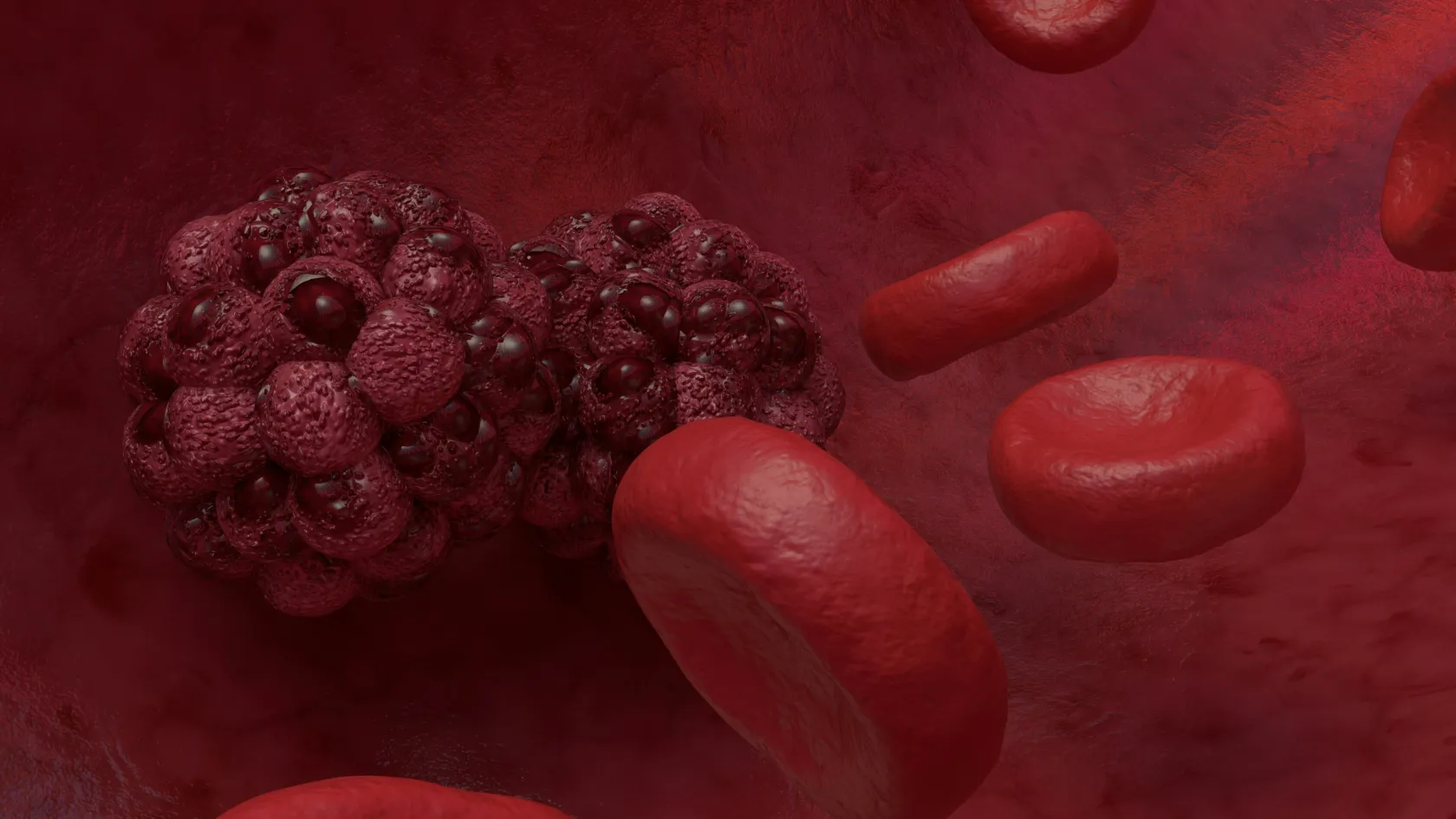 Tumor Embolization