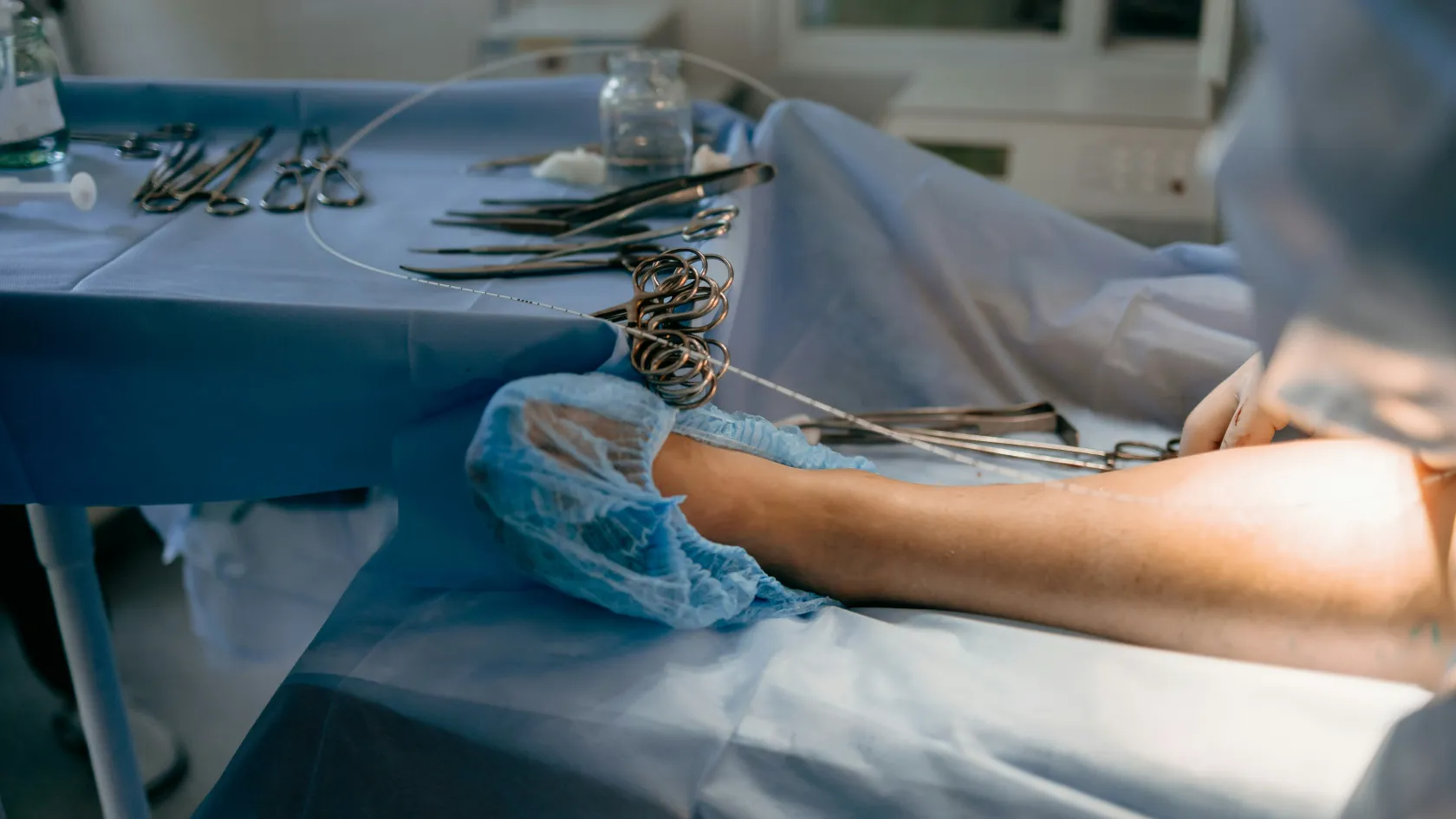 Varicose Vein Treatment
