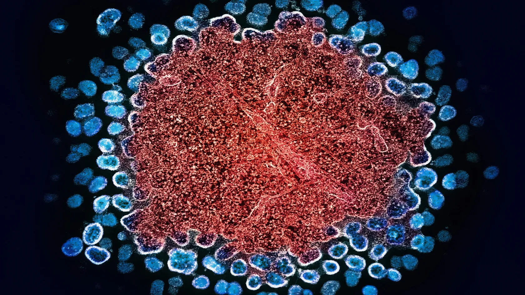 Sacituzumab Govitecan Therapy - Trodelvy