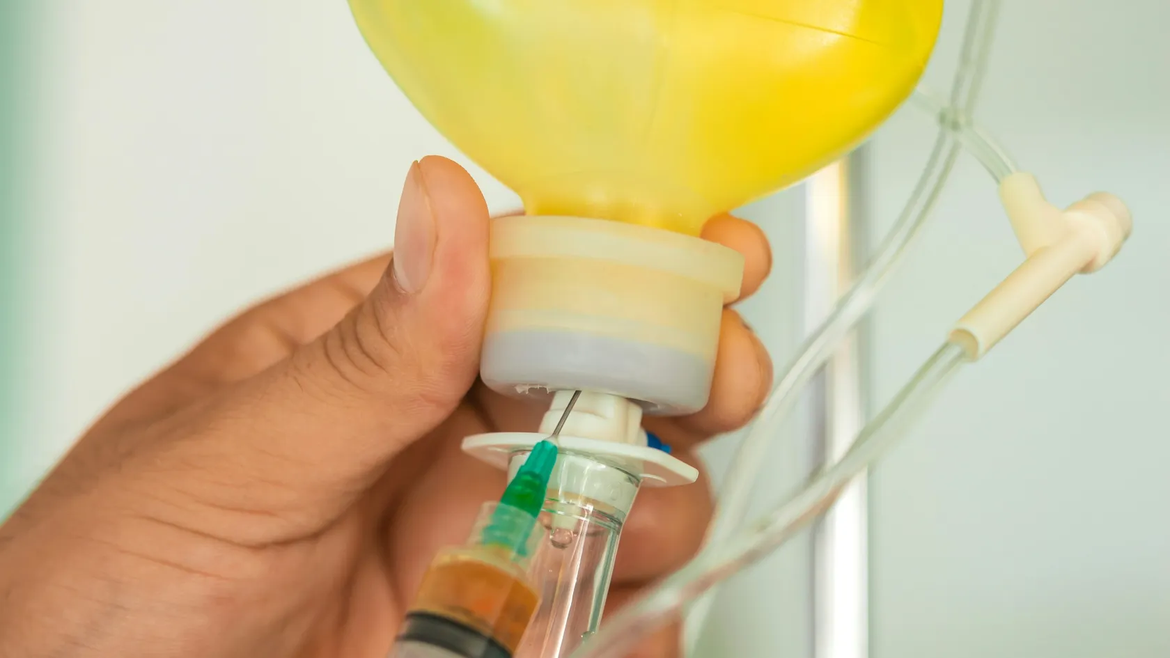FOLFOX Chemotherapy