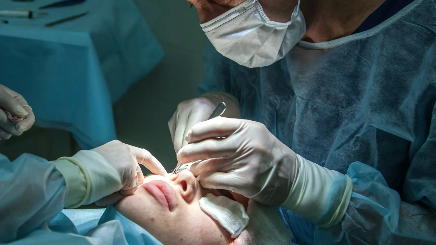 Rhinoplasty