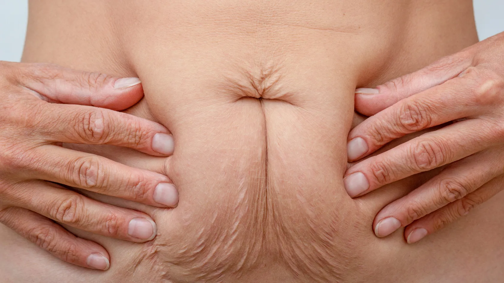 Vaser Liposuction
