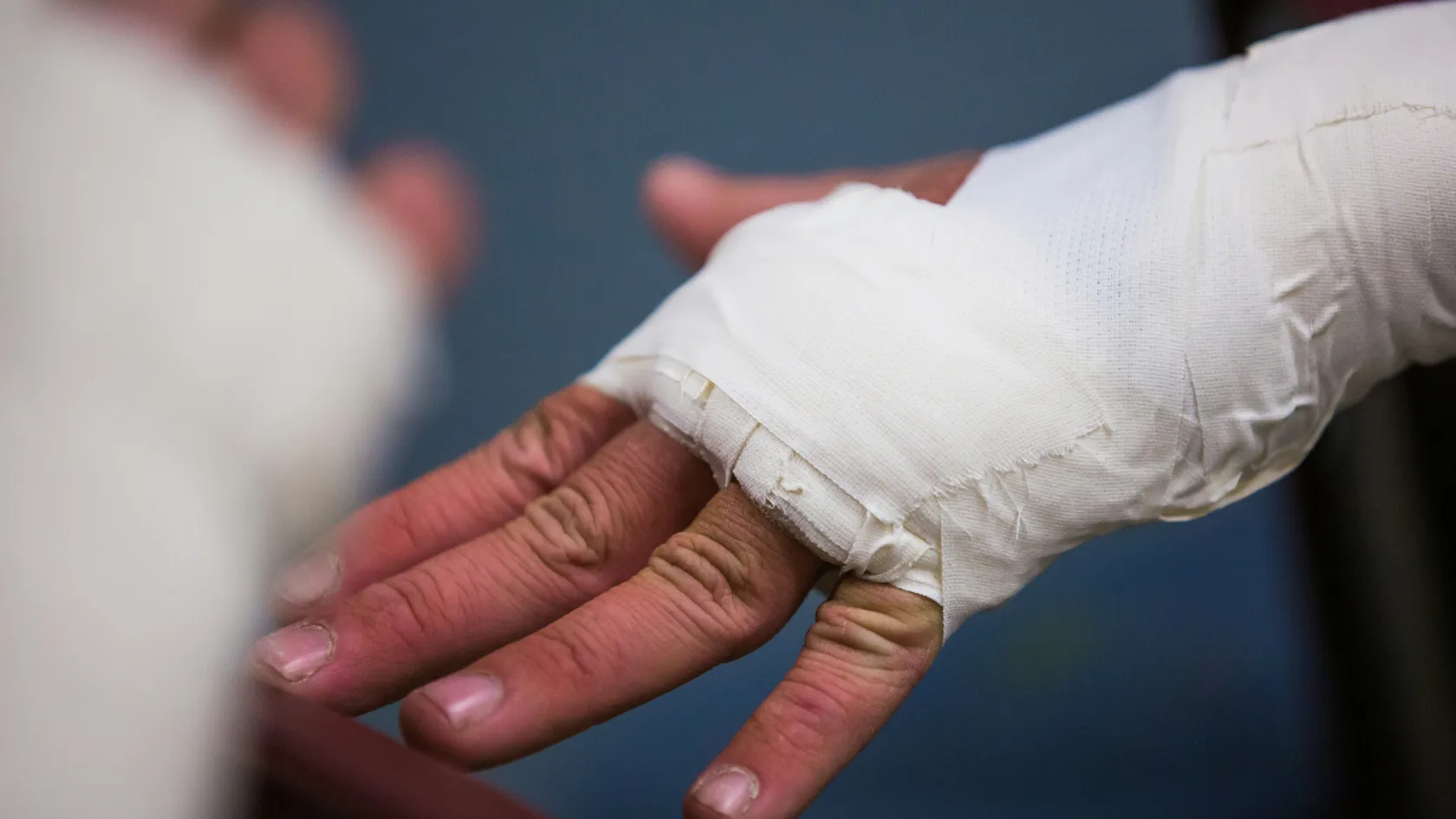 Burn Reconstruction Surgery