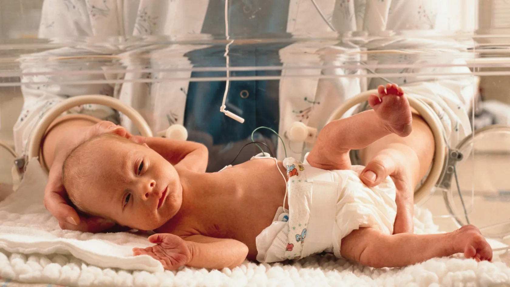 Laparoscopic Pediatric Hernia Repair