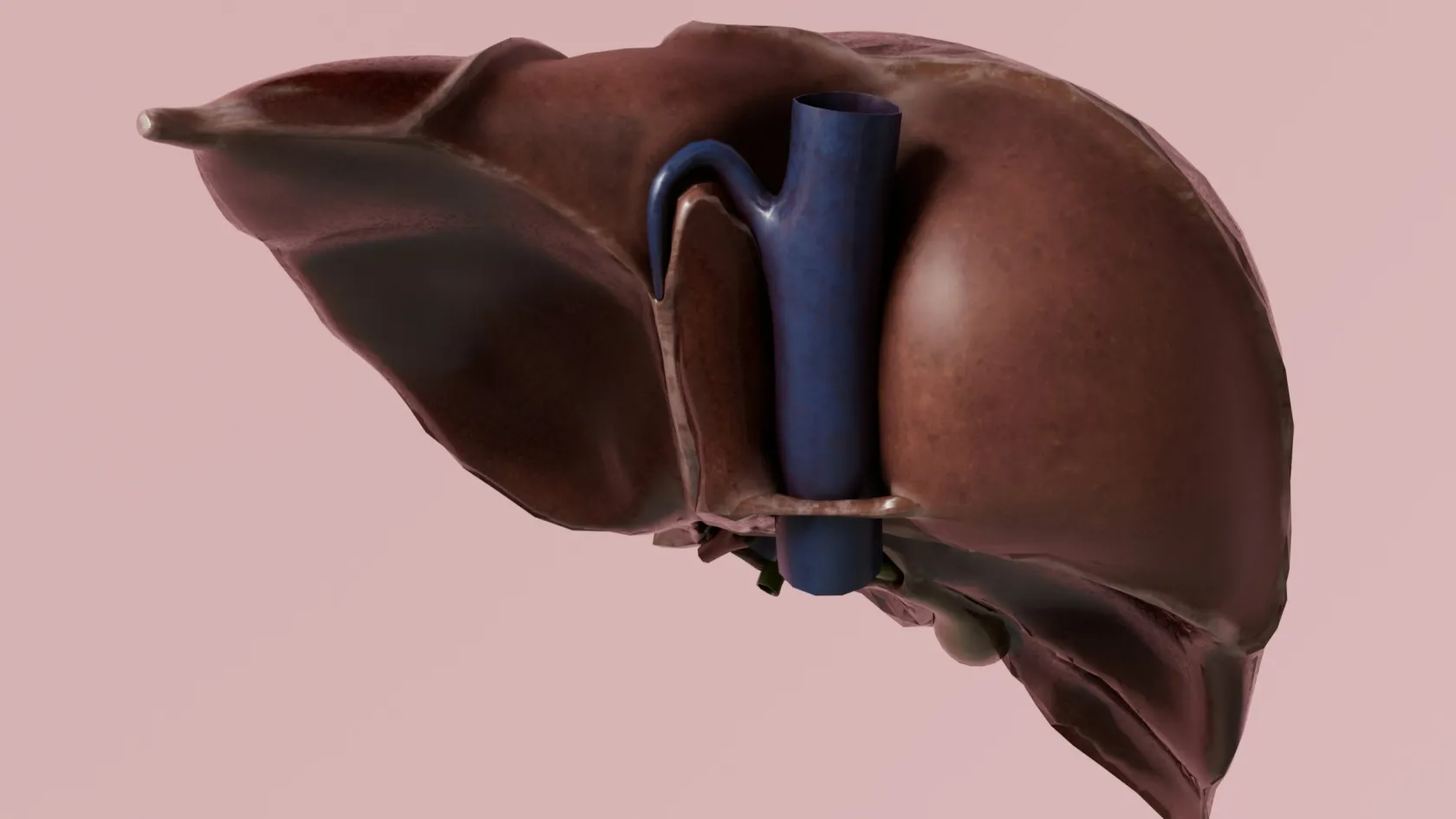 Liver Transplant For Biliary Atresia