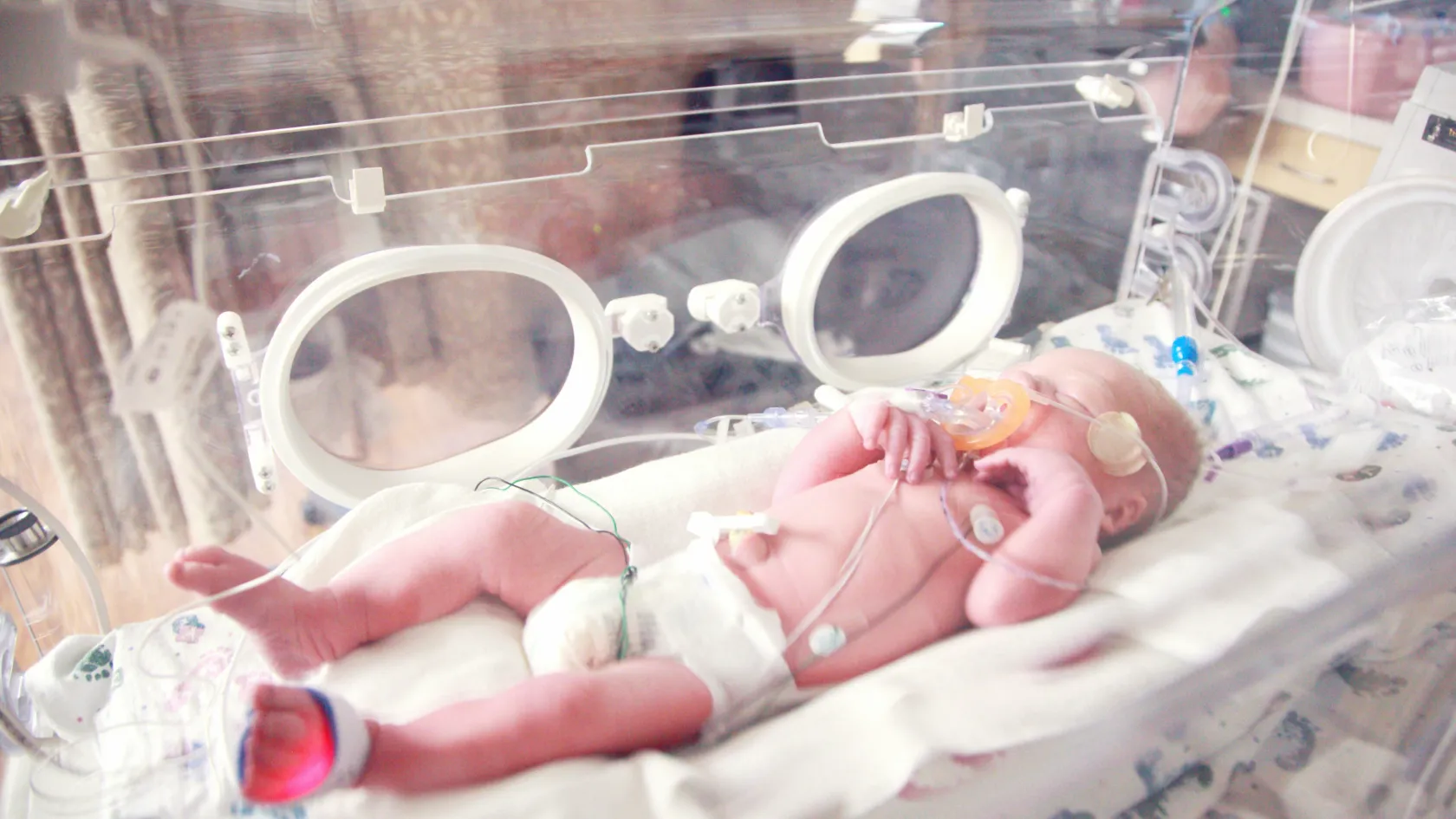 Neonatal Surgery - Newborn Surgery